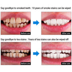 Lanbena Teeth Whitening Essence