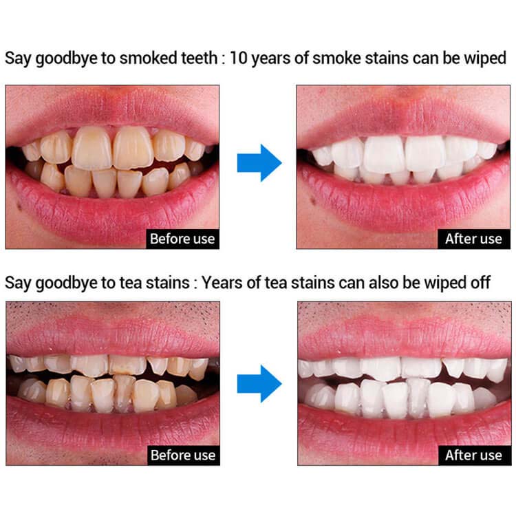 Lanbena Teeth Whitening Essence