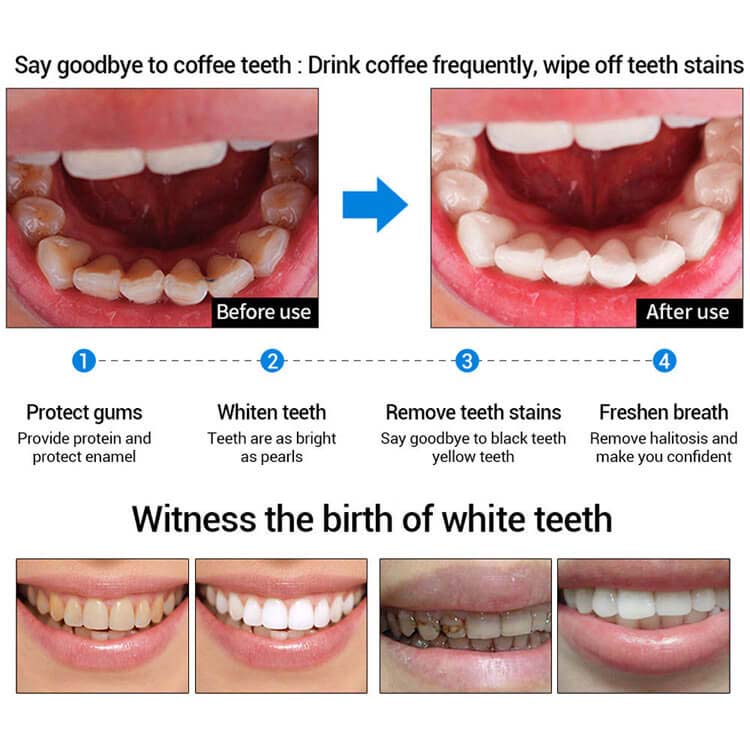 Lanbena Teeth Whitening Essence