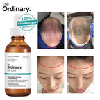 The Ordinary Multi-Peptide Serum for Hair Density