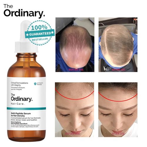 The Ordinary Multi-Peptide Serum for Hair Density