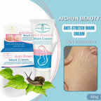 Aichun Beauty Anti Stretch Mark Cream