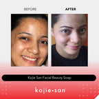 Kojie San Skin Lightening Soap