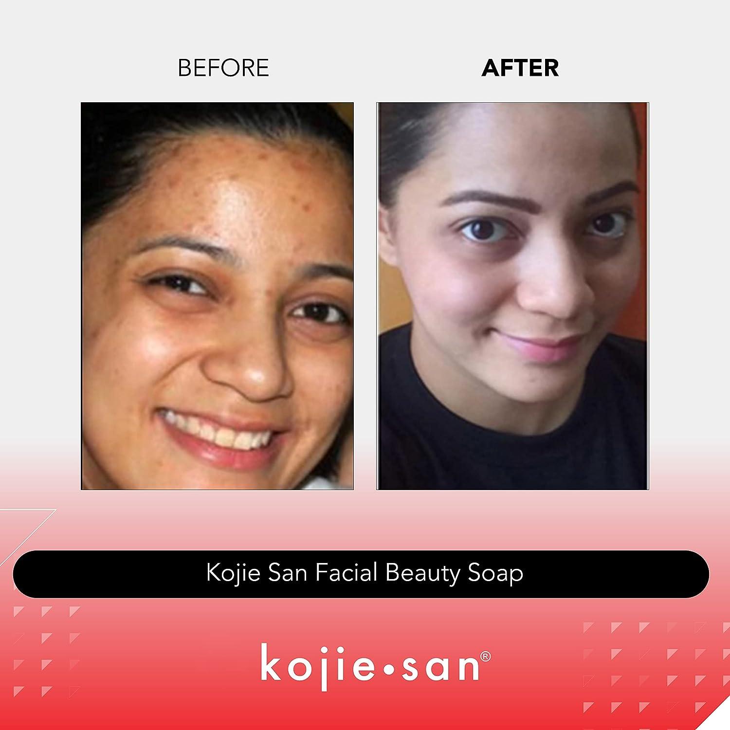 Kojie San Skin Lightening Soap