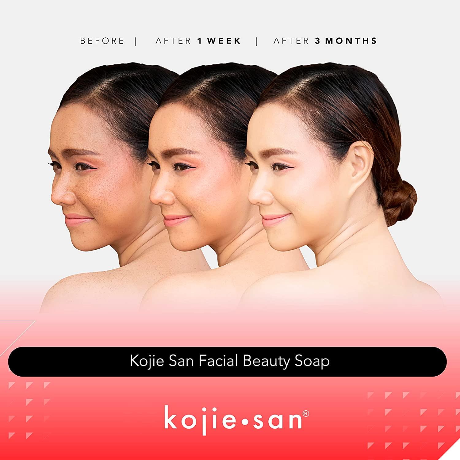 Kojie San Skin Lightening Soap