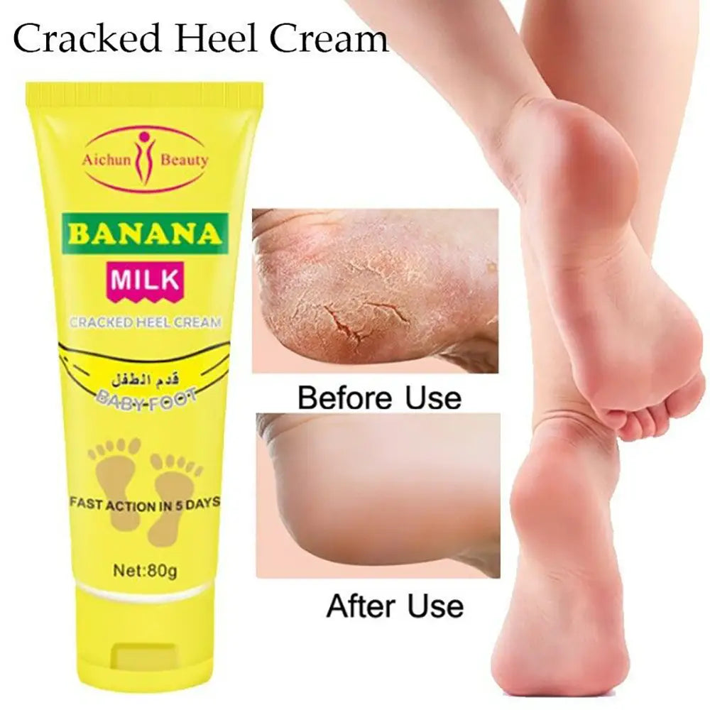 Aichun Beauty Banana Milk Cracked Heel Cream