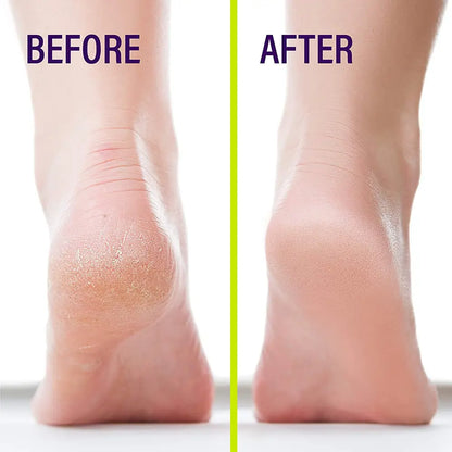Aichun Beauty Banana Milk Cracked Heel Cream