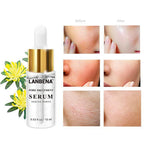 Lanbena Pore Treatment Serum