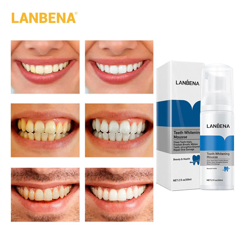 Lanbena Teeth Whitening Mousse