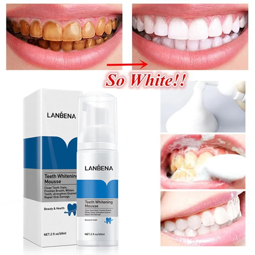 Lanbena Teeth Whitening Mousse