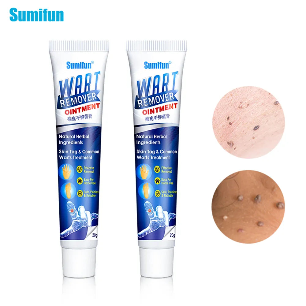 Wart Removal Ointment