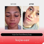 Kojie San Skin Lightening Soap