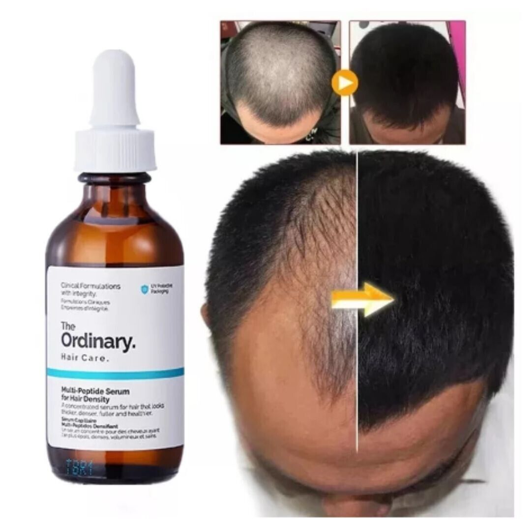 The Ordinary Multi-Peptide Serum for Hair Density