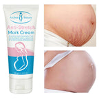 Aichun Beauty Anti Stretch Mark Cream