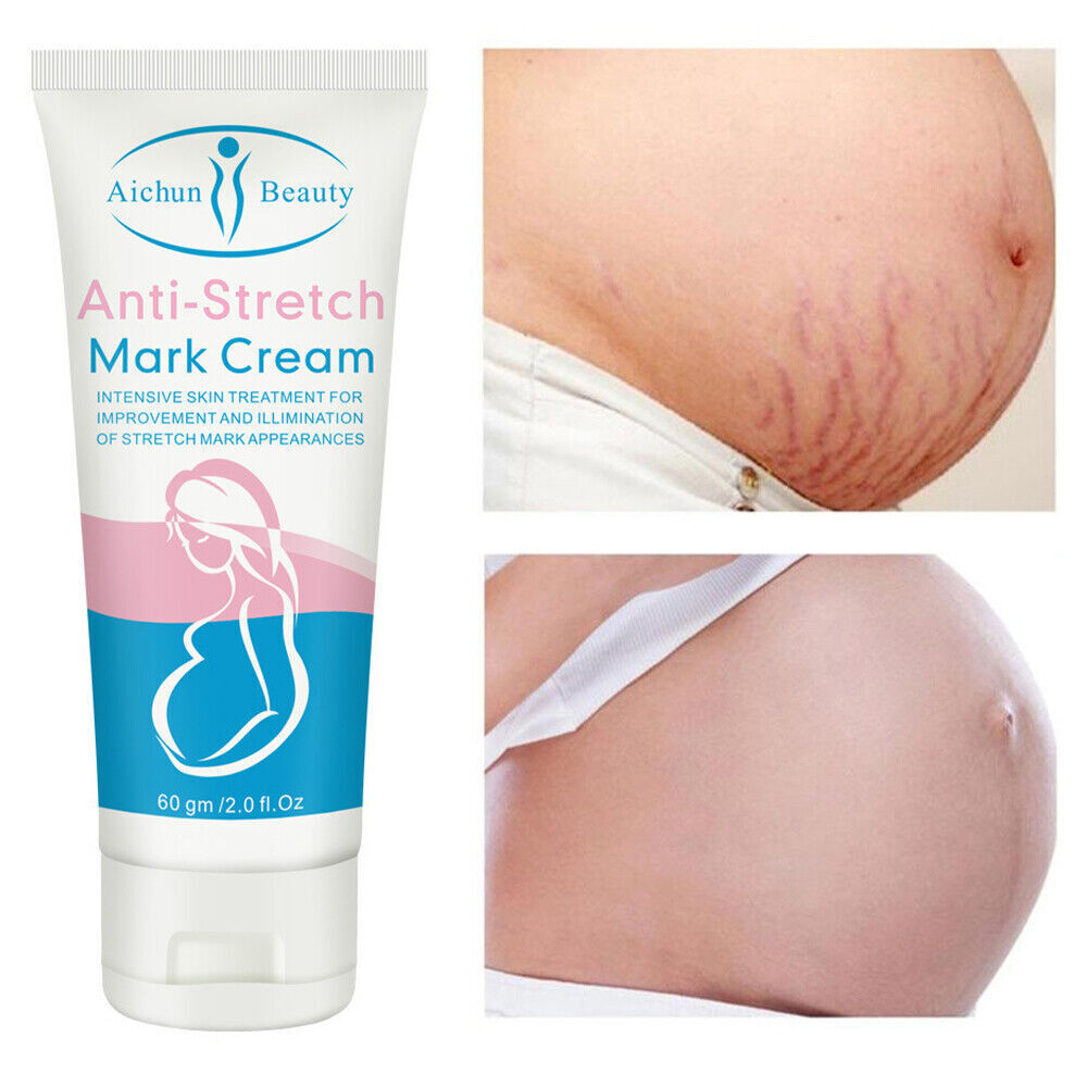 Aichun Beauty Anti Stretch Mark Cream