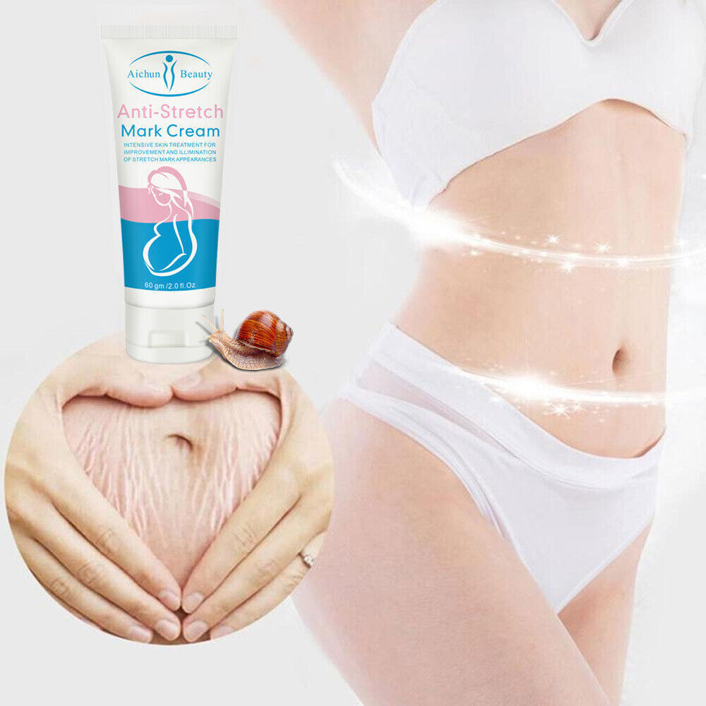 Aichun Beauty Anti Stretch Mark Cream