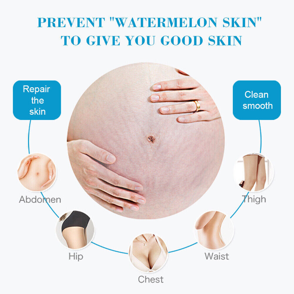 Aichun Beauty Anti Stretch Mark Cream